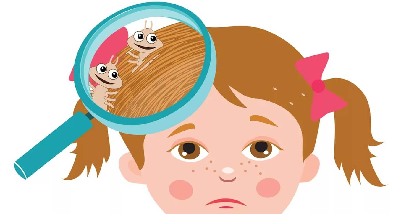 Диагностика и лечение педикулёза
